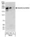 SWI/SNF Related, Matrix Associated, Actin Dependent Regulator Of Chromatin, Subfamily A, Member 2 antibody, NB100-55309, Novus Biologicals, Western Blot image 