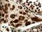 Survival motor neuron protein antibody, 22329-1-AP, Proteintech Group, Immunohistochemistry paraffin image 