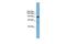 DEAD-Box Helicase 54 antibody, GTX48985, GeneTex, Western Blot image 