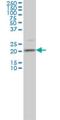 Transgelin 3 antibody, H00029114-M01, Novus Biologicals, Western Blot image 