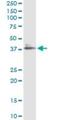 Leukocyte Associated Immunoglobulin Like Receptor 1 antibody, H00003903-M09, Novus Biologicals, Immunoprecipitation image 