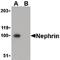 NPHS1 Adhesion Molecule, Nephrin antibody, orb87338, Biorbyt, Western Blot image 