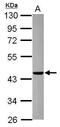 ArfGAP With GTPase Domain, Ankyrin Repeat And PH Domain 1 antibody, GTX116370, GeneTex, Western Blot image 