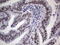 Tousled Like Kinase 2 antibody, LS-C339599, Lifespan Biosciences, Immunohistochemistry paraffin image 