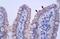 Zinc Finger Protein 358 antibody, PA5-41155, Invitrogen Antibodies, Immunohistochemistry paraffin image 