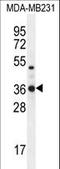 Tryptase Delta 1 antibody, LS-C160150, Lifespan Biosciences, Western Blot image 