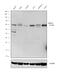 Coactivator Associated Arginine Methyltransferase 1 antibody, MA5-15796, Invitrogen Antibodies, Western Blot image 