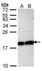 Ubiquitin Conjugating Enzyme E2 L3 antibody, PA5-21598, Invitrogen Antibodies, Western Blot image 