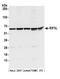Eukaryotic Translation Initiation Factor 3 Subunit L antibody, A304-753A, Bethyl Labs, Western Blot image 