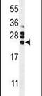 Colony Stimulating Factor 2 antibody, PA5-24184, Invitrogen Antibodies, Western Blot image 