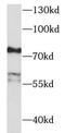 Embryonal Fyn-associated substrate antibody, FNab02662, FineTest, Western Blot image 