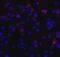 DExD/H-Box Helicase 58 antibody, 3953, ProSci, Immunofluorescence image 