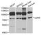 Interleukin 2 Receptor Subunit Beta antibody, STJ27963, St John