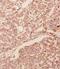 Glial Cell Derived Neurotrophic Factor antibody, LS-C312624, Lifespan Biosciences, Immunohistochemistry paraffin image 