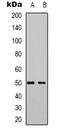 ZFP36 Ring Finger Protein Like 2 antibody, LS-C368658, Lifespan Biosciences, Western Blot image 