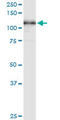 Minichromosome Maintenance Complex Component 3 antibody, LS-C139330, Lifespan Biosciences, Western Blot image 