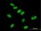 General Transcription Factor IIE Subunit 1 antibody, H00002960-B01P, Novus Biologicals, Immunocytochemistry image 