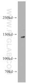 Kinesin Family Member 1C antibody, 12760-1-AP, Proteintech Group, Western Blot image 