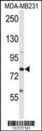 ADAM Metallopeptidase Domain 9 antibody, 62-910, ProSci, Western Blot image 