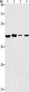 Protein Kinase X-Linked antibody, TA350786, Origene, Western Blot image 