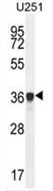 Antagonist Of Mitotic Exit Network 1 Homolog antibody, AP50163PU-N, Origene, Western Blot image 