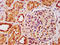 IST1 Factor Associated With ESCRT-III antibody, LS-C670478, Lifespan Biosciences, Immunohistochemistry paraffin image 