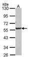 Dickkopf WNT Signaling Pathway Inhibitor 3 antibody, GTX100571, GeneTex, Western Blot image 