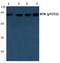 Bruton Tyrosine Kinase antibody, A00245Y222, Boster Biological Technology, Western Blot image 