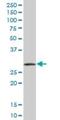 Regulation Of Nuclear Pre-MRNA Domain Containing 1A antibody, H00055197-B01P, Novus Biologicals, Western Blot image 