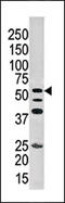 Inositol-Trisphosphate 3-Kinase A antibody, AP15174PU-N, Origene, Western Blot image 