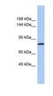 Kelch Like Family Member 32 antibody, NBP1-56298, Novus Biologicals, Western Blot image 