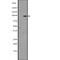 Discoidin Domain Receptor Tyrosine Kinase 2 antibody, abx147505, Abbexa, Western Blot image 