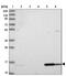 Dual Specificity Phosphatase 23 antibody, NBP1-91855, Novus Biologicals, Western Blot image 