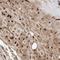 MKL1 antibody, NBP1-88498, Novus Biologicals, Immunohistochemistry frozen image 