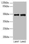 DBF4 Zinc Finger B antibody, CSB-PA822784LA01HU, Cusabio, Western Blot image 