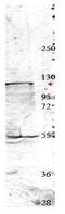 NEDD4 E3 Ubiquitin Protein Ligase antibody, GTX48706, GeneTex, Western Blot image 