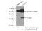 CCR4-NOT Transcription Complex Subunit 7 antibody, 14102-1-AP, Proteintech Group, Immunoprecipitation image 