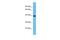 Olfactory Receptor Family 5 Subfamily T Member 2 antibody, PA5-71192, Invitrogen Antibodies, Western Blot image 