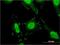 Solute Carrier Family 4 Member 1 (Diego Blood Group) antibody, H00006521-M02, Novus Biologicals, Immunocytochemistry image 