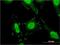Solute Carrier Family 4 Member 1 (Diego Blood Group) antibody, H00006521-M02, Novus Biologicals, Immunocytochemistry image 
