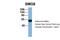SMG8 Nonsense Mediated MRNA Decay Factor antibody, PA5-44698, Invitrogen Antibodies, Western Blot image 