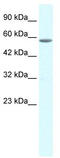 General Transcription Factor IIE Subunit 1 antibody, TA330119, Origene, Western Blot image 