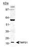 Transmembrane P24 Trafficking Protein 10 antibody, PA1-46004, Invitrogen Antibodies, Western Blot image 