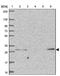 G Protein-Coupled Receptor 171 antibody, NBP2-32359, Novus Biologicals, Western Blot image 