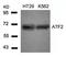 Activating Transcription Factor 2 antibody, orb14446, Biorbyt, Western Blot image 