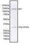 Nicotinamide Nucleotide Transhydrogenase antibody, 459170, Invitrogen Antibodies, Western Blot image 