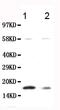 Calmodulin antibody, PA1519, Boster Biological Technology, Western Blot image 