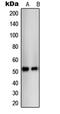 Thyroid Hormone Receptor Beta antibody, LS-C352939, Lifespan Biosciences, Western Blot image 