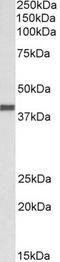 C-X-C Motif Chemokine Receptor 1 antibody, TA334182, Origene, Western Blot image 