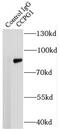 Cell Cycle Progression 1 antibody, FNab01388, FineTest, Immunoprecipitation image 